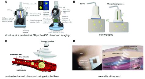 Ultrasound technology applications in medicine. (A) (See in Figure 1 in ...