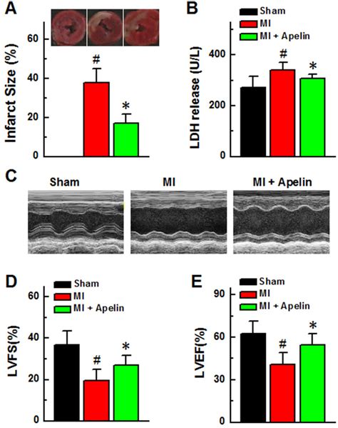 Apelin Improves Cardiac Function In Mi Mice A Myocardial Infarct