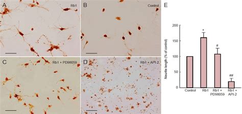 Neuroprotective Effects Of Ginsenoside Rb On Hippocampal Ne