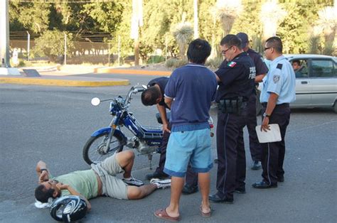 Motociclista Sufre Fractura De Pierna Al Ser Atropellado El Siglo De