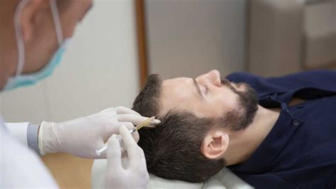 What Makes Prf Hair Treatment A Breakthrough In Hair Restoration Prp