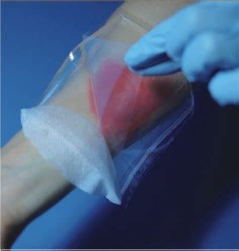 Wound Healing Dressings And Drug Delivery Systems: A Review