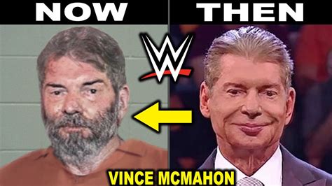 Vince Mcmahon Before After