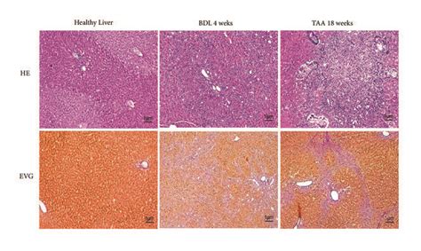 Histological Evaluation Of Healthy Fibrotic And Cirrhotic Livers