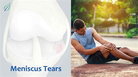 Understanding Meniscus Tears Causes Symptoms And Treatment Options Best Back Pain Slip