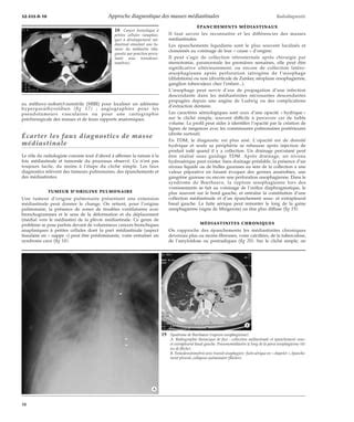 Approche diagnostique des masses médiastinales PDF