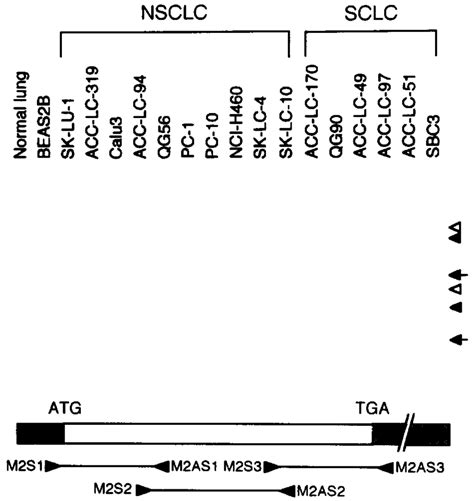 Pcr ± Sscp Analysis Of The Hsmad2 Gene In Lung Cancer Cell Lines Two