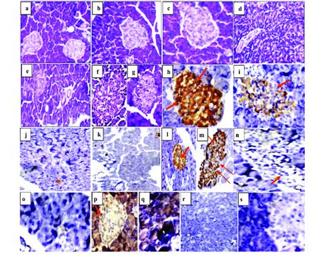 Pancreatic Sections Of Rat Showing A B And C Normal Sized Stained Download Scientific