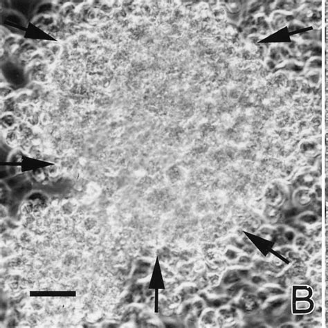 Phase Contrast Microscopy Of Plaque Formation By The Hge Agent In