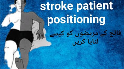 How To Position A Stroke Patientstroke Patient Lying Positionstroke