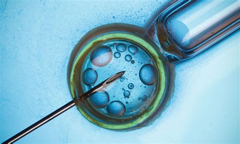 Semen Analysis And Treatments At Irs Fertility