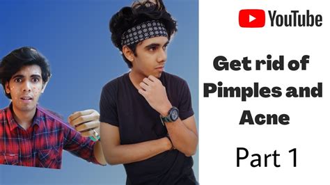 Get Rid Of Pimples And Acne Part 1 7 Easy Steps To Reduce Your Pimples Aditya Lagad Youtube