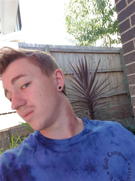 When a hookup ignores your no hickeys policy 😡😡🤬 : r/gaybrosgonemild