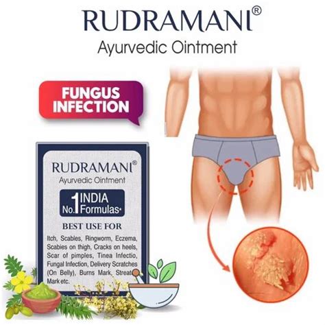 Rudramani Ayurvedic Fungal Ointment 25gm At Rs 100 Piece Antifungal