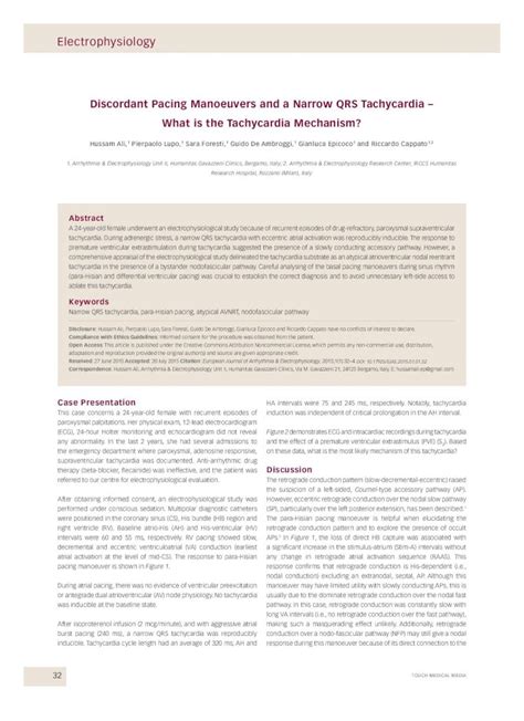 PDF Discordant Pacing Manoeuvers And A Narrow QRS Tachycardia