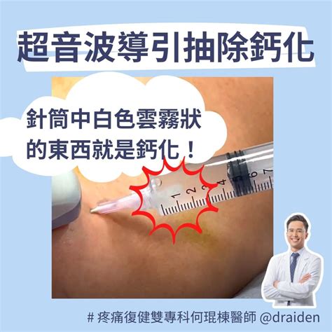 鈣化性肌腱炎，肩膀突然劇痛，痛到不能動！ 何琨棟醫師 Dr Aiden