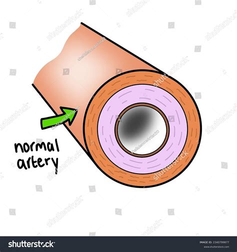 Normal Artery Diagram Science Illustration Drawing Stock Illustration