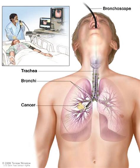 Chapter 2 Review On Image Guided Lung Biopsy Semantic Scholar