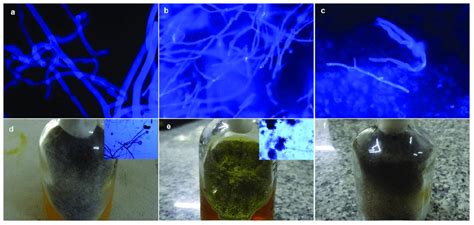 A Koh Cfw Mount Showing Broad Aseptate Fungal Hyphae B Koh Cfw