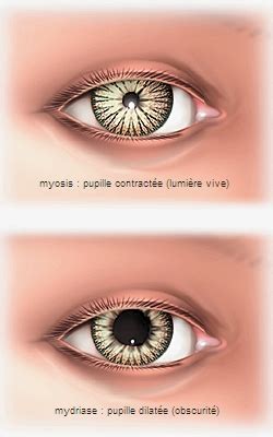 Myosis Larousse