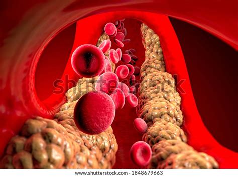 Fats Triglycerides Stock Photos 994 Images Shutterstock