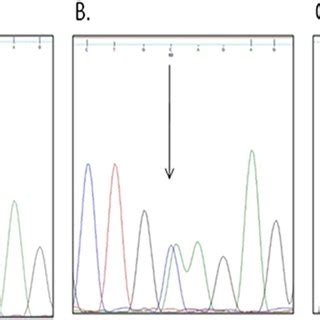 Gel Electrophoresis Of PCR RFLP Products For Representative Blood