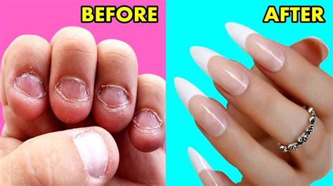 How To Grow Long Strong Nails Fast At Home Diy Making Nails