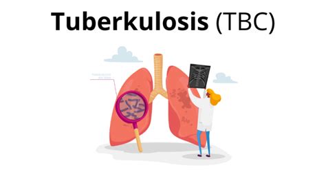 Apa Itu Tuberkulosis TBC Yayasan KNCV Indonesia