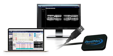 Dental X-Ray Sensors & Dental Software - DentiMax