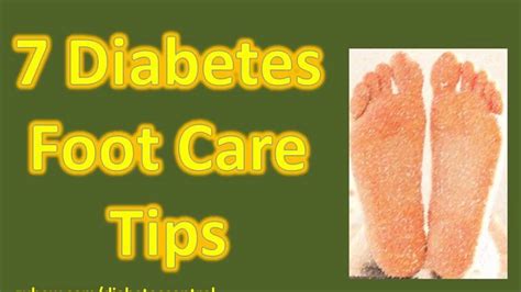 7 Diabetes Foot Care Tips Prevent Foot Problems Youtube