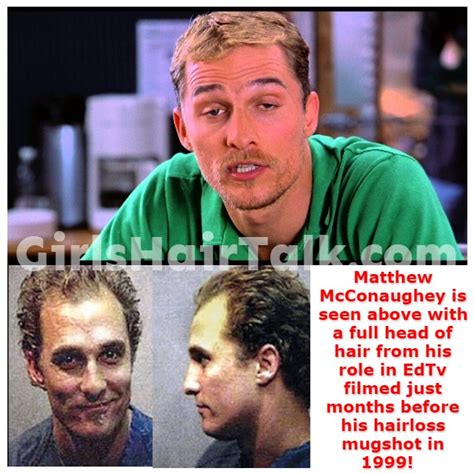 Matthew Mcconaughey Hair Loss, What's His Hair Growth Secret?