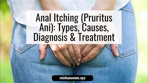 Anal Itching Pruritus Ani Types Causes Diagnosis Treatment YouTube