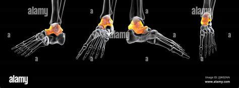 Illustration Of The Talus Bone Of The Foot Stock Photo Alamy