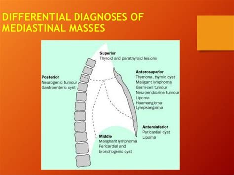 Mediastinal Mass