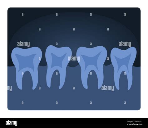 Dental Xray Scan Human Teeth Radiography Medical Test Of Human Tooth