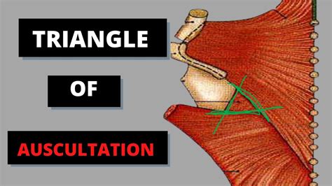 Triangle Of Auscultation I Upper Limb Anatomy Youtube