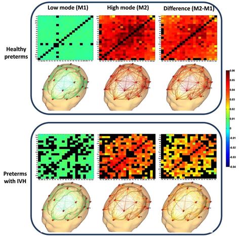 13 Grand Mean Connectivity Matrices And 3d Maps Of Eeg Electrodes At