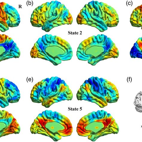 Dynamic Functional Connectivity Dfc Patterns Of States In Typically