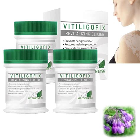 Vitiligo Fix Revitalize Elixir Cream | Psoriasis Relief | Moisturizer for Skin | Reduce White ...