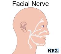 CN7 Facial Nerve Damage