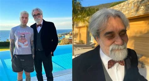 Beppe Vessicchio Ha Un Occhio Nero Incidente A Sanremo Fedez Ecco