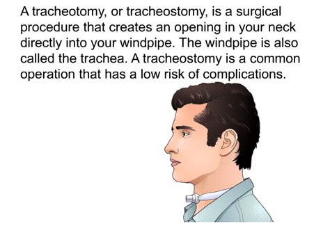 PatEdu Tracheostomy Care In The Hospital