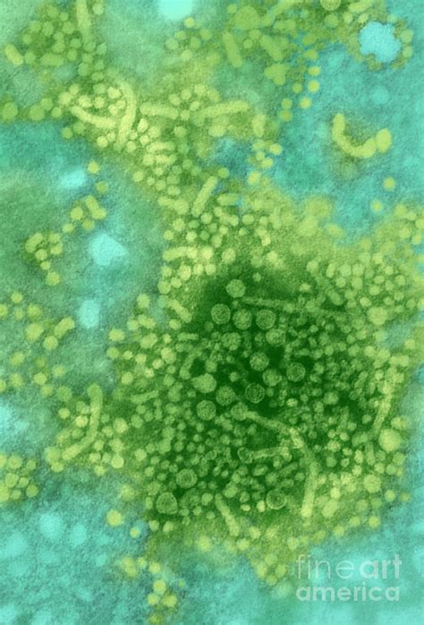 Hepatitis B Tem Photograph By Science Source Fine Art America