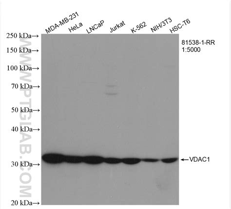 Vdac Porin Antibody Rr Proteintech