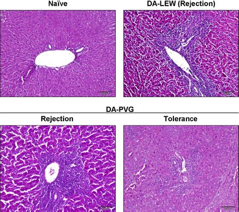 Figure From Immunological And Regenerative Aspects Of Hepatic Mast