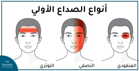 أنواع الصداع وأسبابه في تركيا بيمارستان