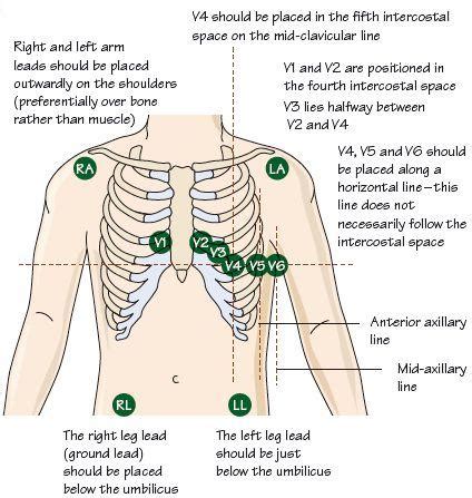 Introduction to the ECG | Thoracic Key