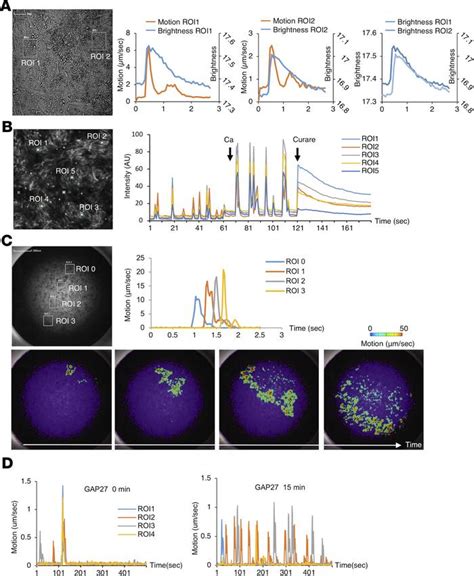 Jci Insight Ipsc Derived Functional Human Neuromuscular Junctions