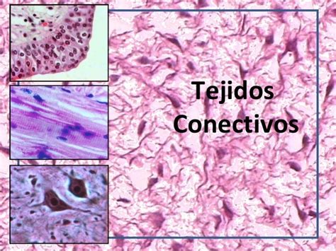 Tejidos Conectivos