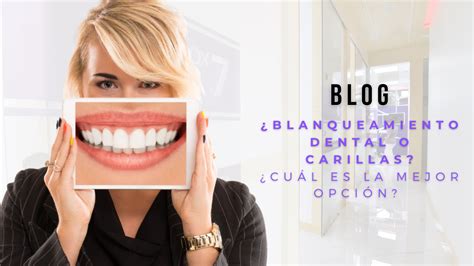 Blanqueamiento Dental O Carillas Cu L Es La Mejor Opci N Cl Nica